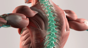 Plainville thoracic spine